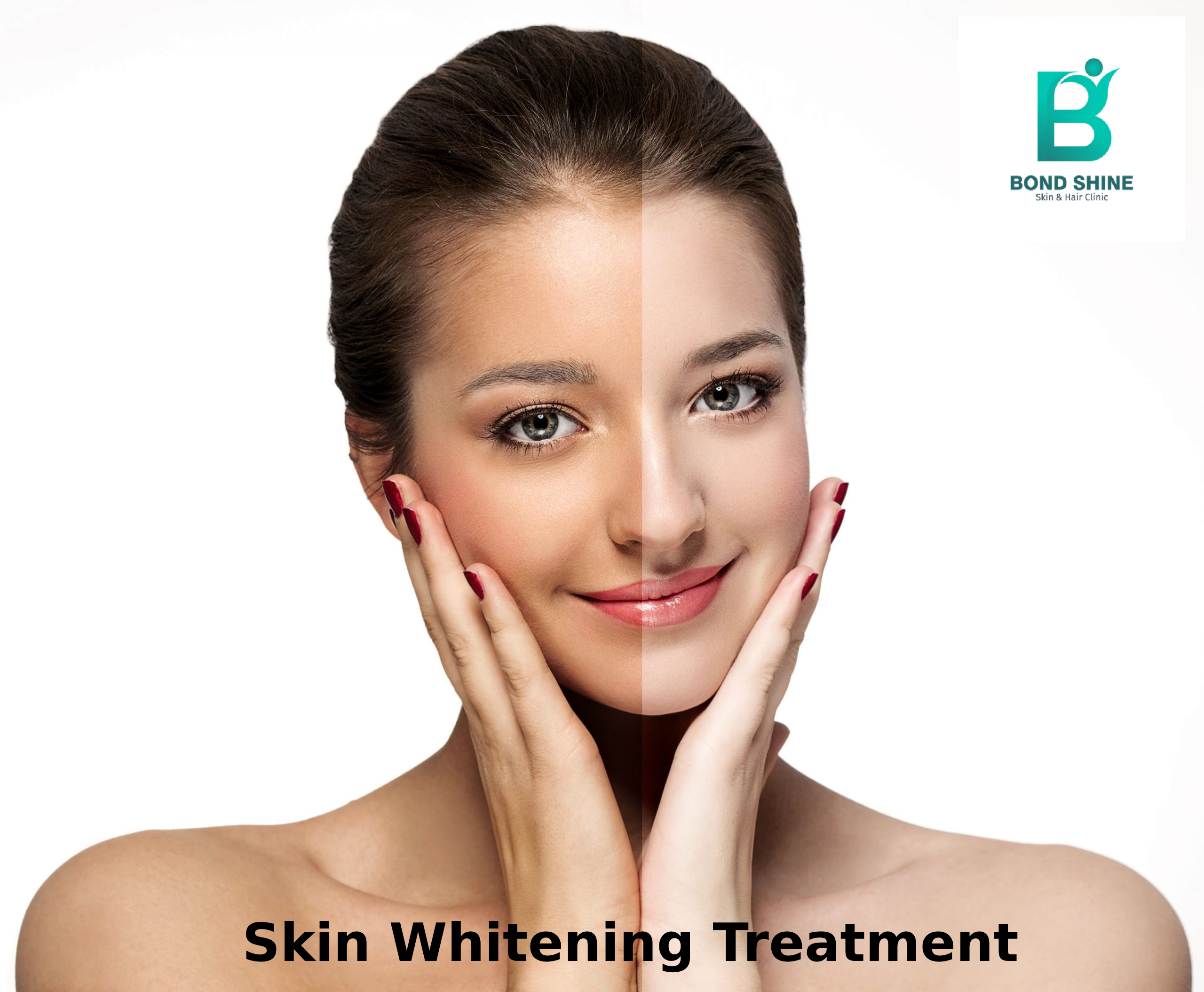 Skin Whitening